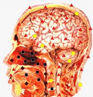 /album/fotogaleria-celkovy-stav-organizmu/hlava-jpg1/