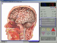 /album/fotogaleria-celkovy-stav-organizmu/bios3-jpg/